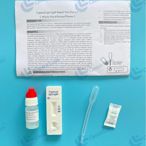 Typhoid IgG, IgM Test
